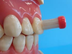 歯ブラシを歯の面に対して垂直に当てている写真