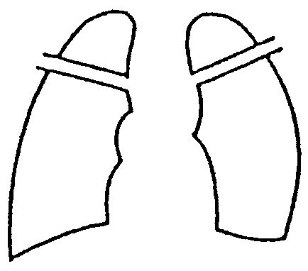 C[W