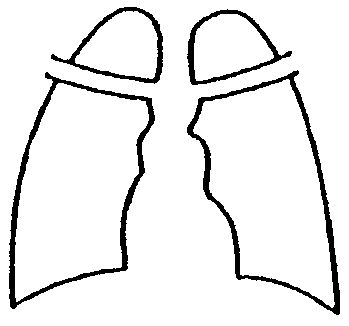 C[W