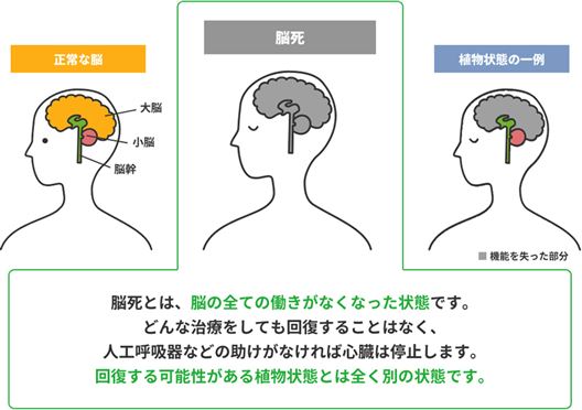 脳死とは