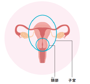 子宮委頸がん部位