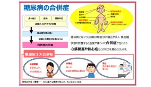 糖尿病の合併症