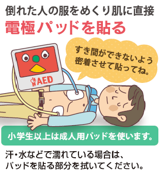 電極パッドを貼る