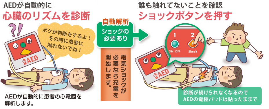 AEDが心臓リズム診断 ショックボタンを押す AEDが心臓リズム診断 ショックボタンを押す