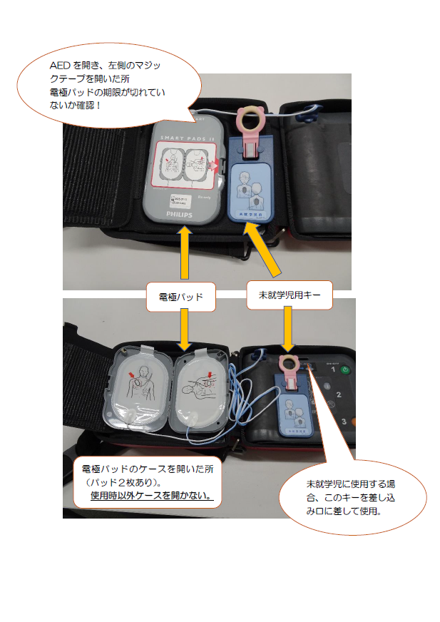 AED点検（電極パッド・未就学児用キー）