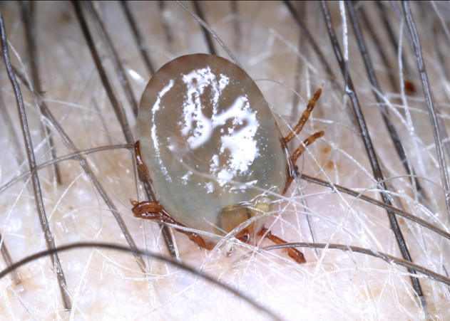 キチマダニの写真1